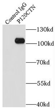 CTNND1 Rabbit Polyclonal Antibody