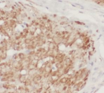 CTNND1 Rabbit Polyclonal Antibody