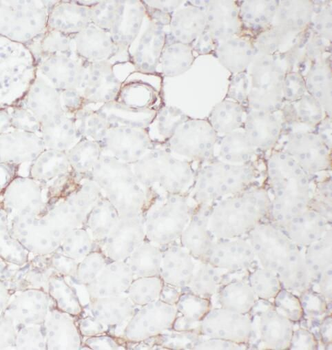 P2RX4 Rabbit Polyclonal Antibody