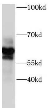 P2RX7 Rabbit Polyclonal Antibody