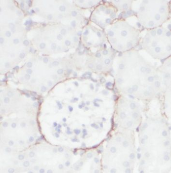 P2RX7 Rabbit Polyclonal Antibody
