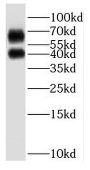 P2RY1 Rabbit Polyclonal Antibody