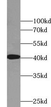MAPK14 Rabbit Polyclonal Antibody