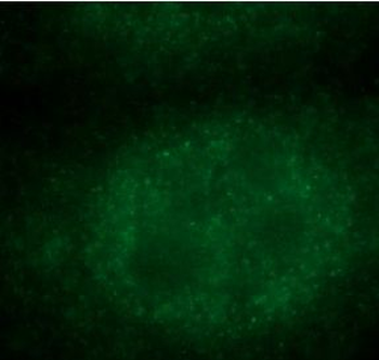 MAPK14 Rabbit Polyclonal Antibody