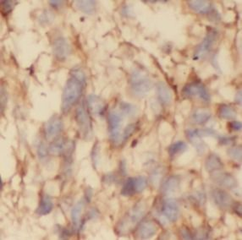 MAPK14 Rabbit Polyclonal Antibody