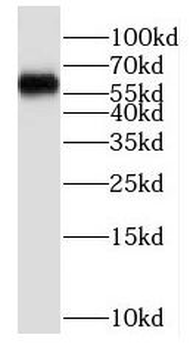 P4HA2 Rabbit Polyclonal Antibody