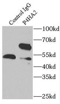 P4HA2 Rabbit Polyclonal Antibody