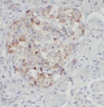 P4HA2 Rabbit Polyclonal Antibody