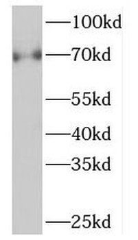 NGFR Rabbit Polyclonal Antibody