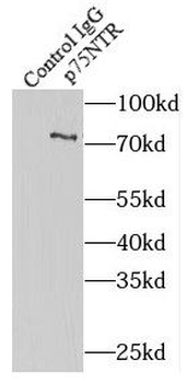 NGFR Rabbit Polyclonal Antibody