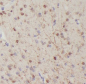 NGFR Rabbit Polyclonal Antibody