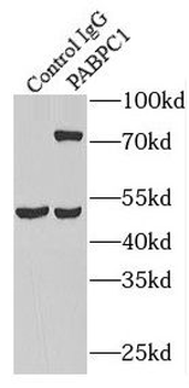 PABPC1 Rabbit Polyclonal Antibody