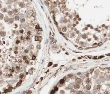 PABPC1 Rabbit Polyclonal Antibody
