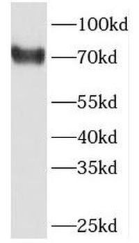 PABPC3 Rabbit Polyclonal Antibody