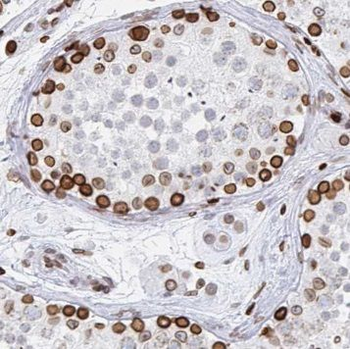 PABPC3 Rabbit Polyclonal Antibody