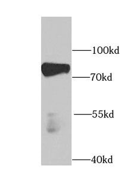 PABPC4 Rabbit Polyclonal Antibody