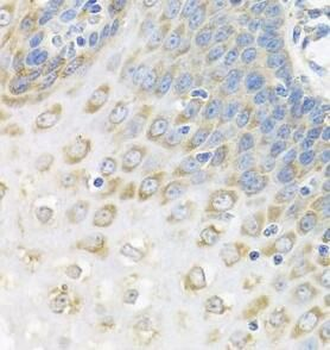 PABPC4 Rabbit Polyclonal Antibody