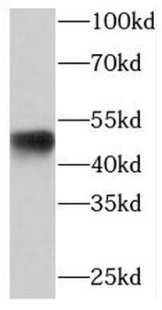 PACSIN3 Rabbit Polyclonal Antibody