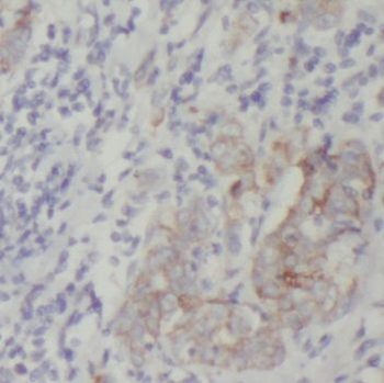 PACSIN3 Rabbit Polyclonal Antibody