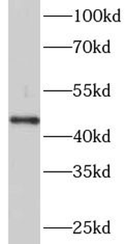 PADI2 Rabbit Polyclonal Antibody