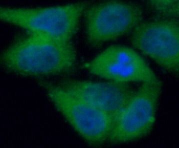 PADI2 Rabbit Polyclonal Antibody