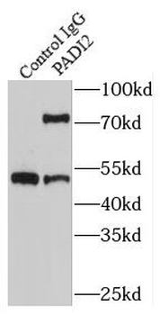 PADI2 Rabbit Polyclonal Antibody
