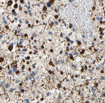 PADI2 Rabbit Polyclonal Antibody