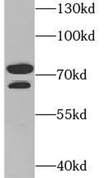 PADI4 Rabbit Polyclonal Antibody