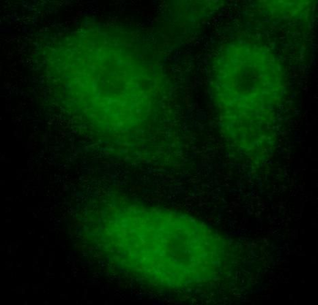 PADI4 Rabbit Polyclonal Antibody