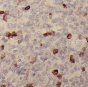 PADI4 Rabbit Polyclonal Antibody
