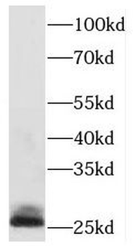 PAFAH1B3 Rabbit Polyclonal Antibody