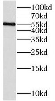 PAG1 Rabbit Polyclonal Antibody