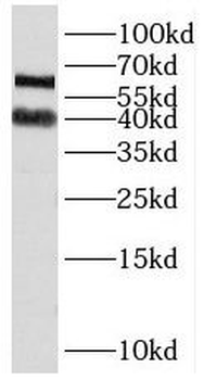 PAIP1 Rabbit Polyclonal Antibody