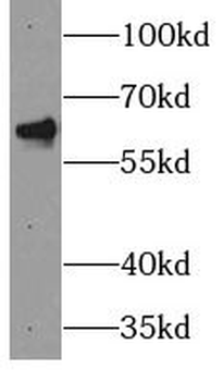 PAK4 Rabbit Polyclonal Antibody