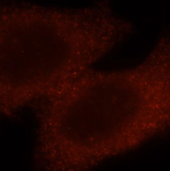 PAK4 Rabbit Polyclonal Antibody