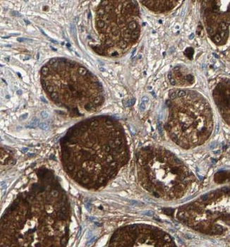 PAK4 Rabbit Polyclonal Antibody