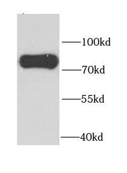 PAK6 Rabbit Polyclonal Antibody