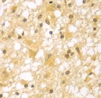 PAK6 Rabbit Polyclonal Antibody