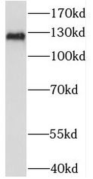 PAN2 Rabbit Polyclonal Antibody