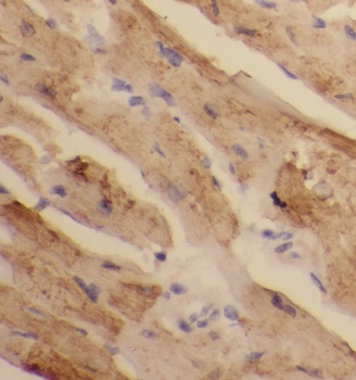 PAN2 Rabbit Polyclonal Antibody