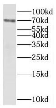 PAPSS1 Rabbit Polyclonal Antibody