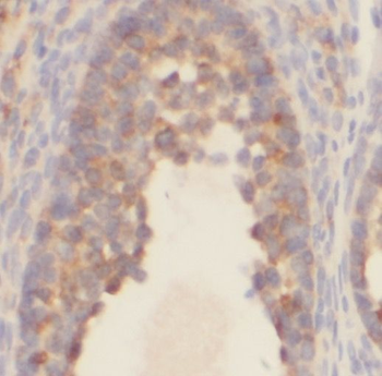 PAPSS1 Rabbit Polyclonal Antibody