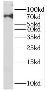 PAPSS2 Rabbit Polyclonal Antibody