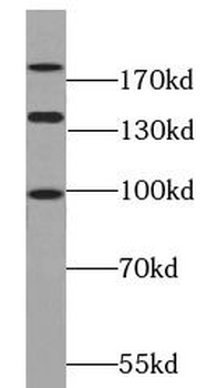 PARD3 Rabbit Polyclonal Antibody