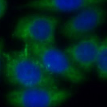 PARD3 Rabbit Polyclonal Antibody