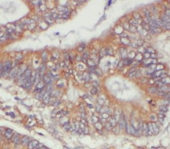 PARD3 Rabbit Polyclonal Antibody
