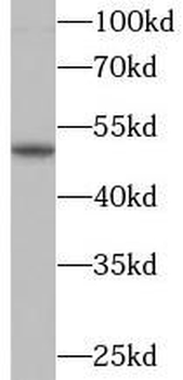 PRKN Rabbit Polyclonal Antibody