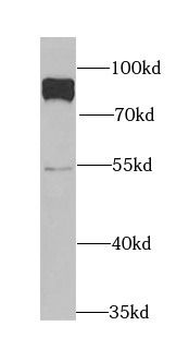 PARN Rabbit Polyclonal Antibody