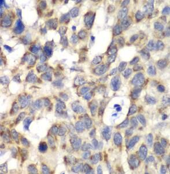 PARN Rabbit Polyclonal Antibody