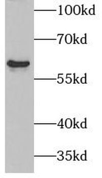 PAX3 Rabbit Polyclonal Antibody